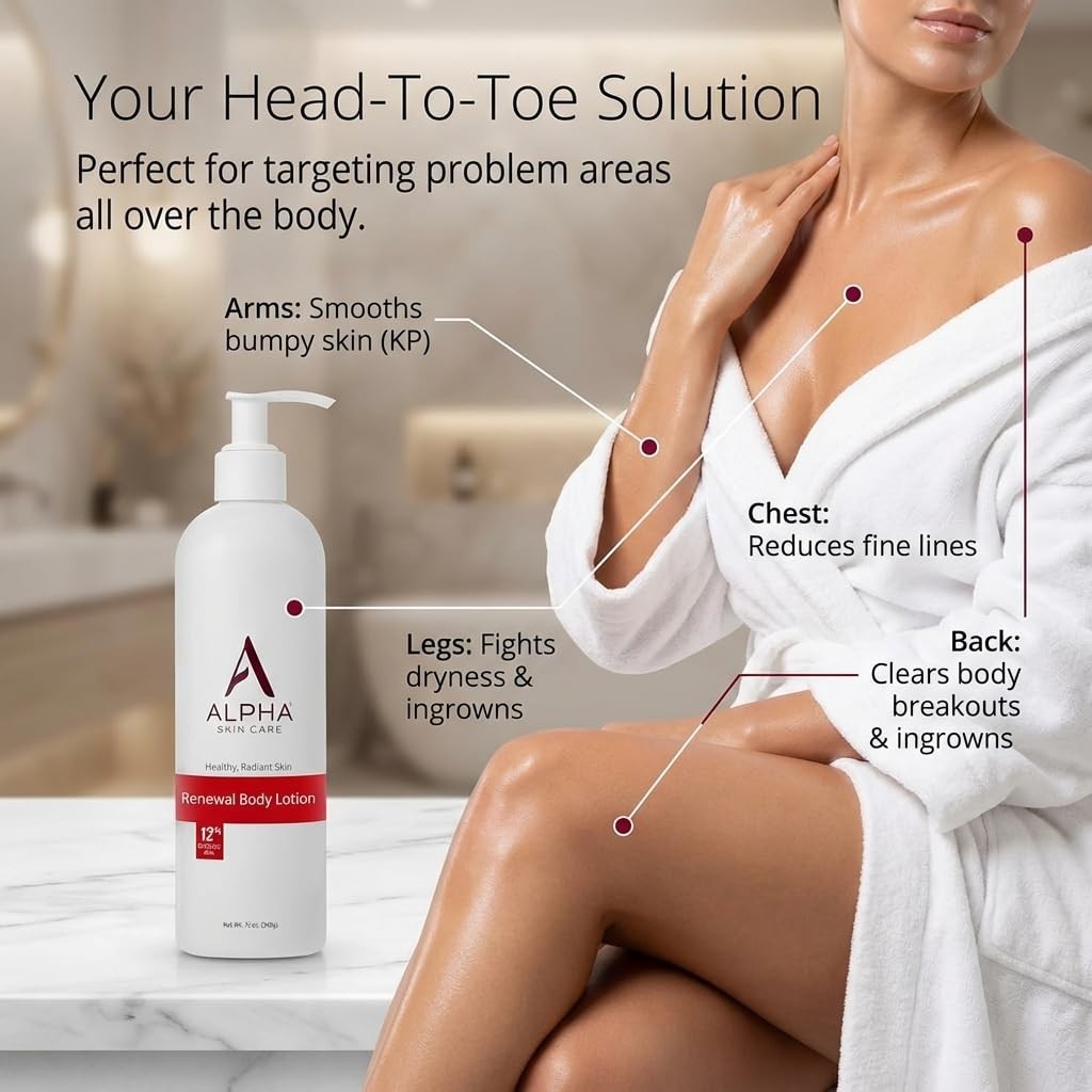 Revitalize & Renew Body Lotion with 12% Glycolic AHA
