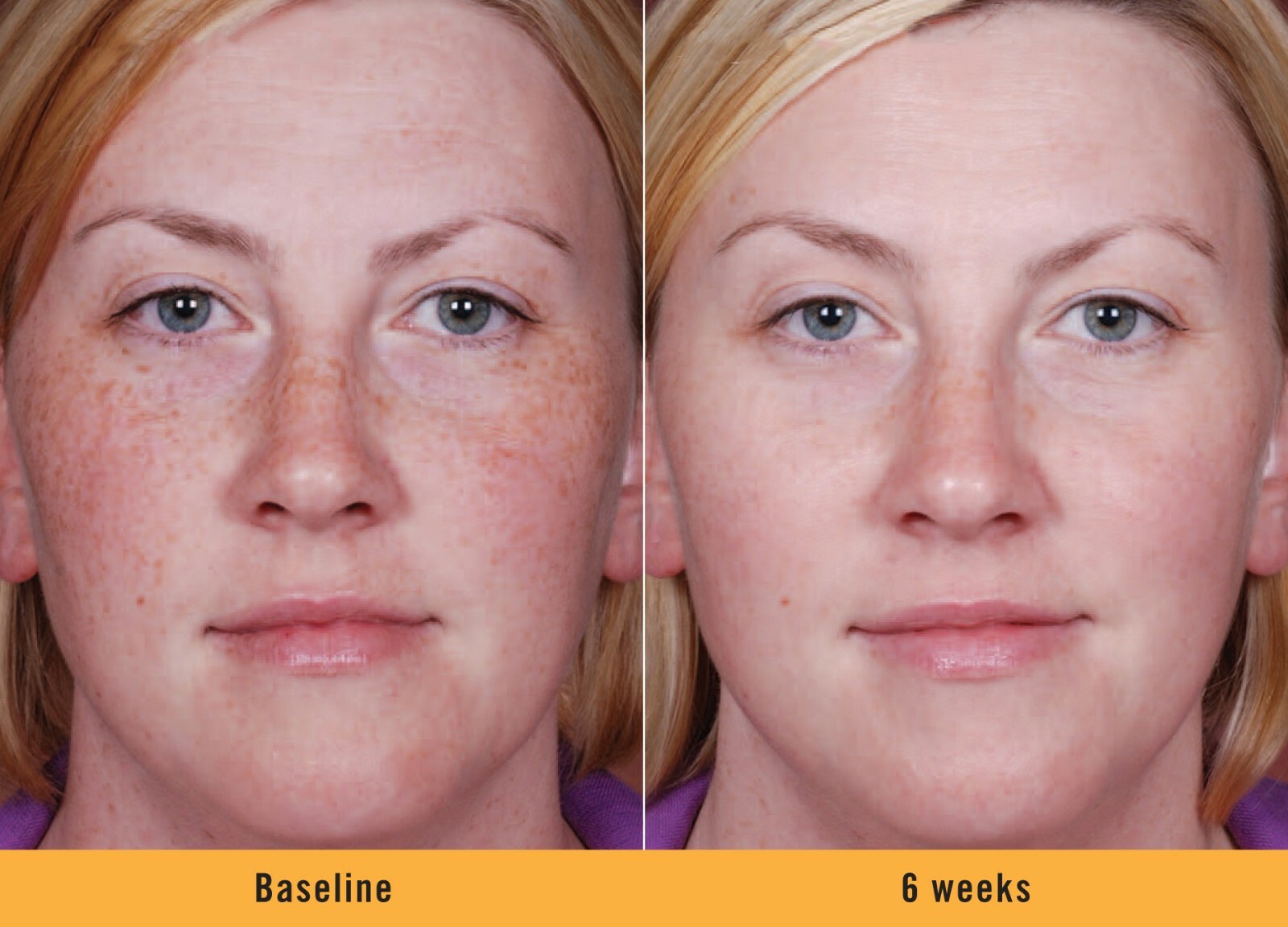 Dark Skin Whitening Lightening Ultra Brightening Serum Dark Spot Bleaching Cream