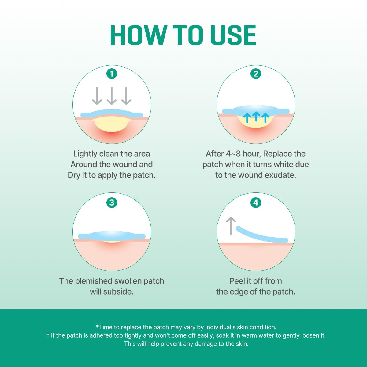 SOME by MI 30 Days Miracle Clear Spot Patch – Pack of 5, 90 Counts, 2 Size(10Mm