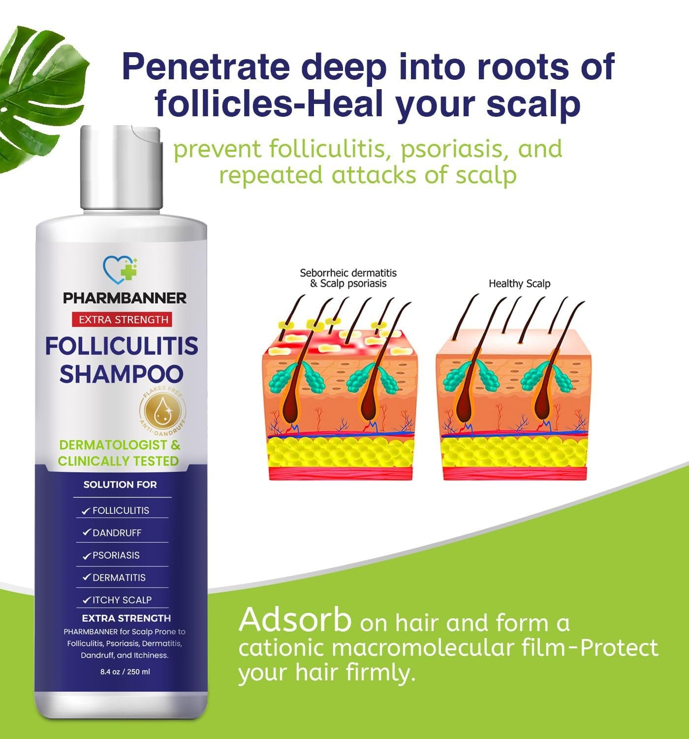 Anti-Fungal Shampoo for Folliculitis, Seborrheic Dermatitis, Scalp Psoriasis – I