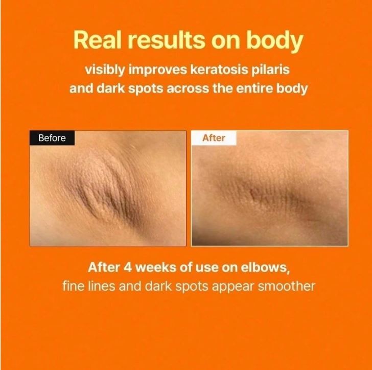 MEDITHERAPY Retinal Skin Booster Serum Beginner-Friendly, Anti-Aging 5.07Fl oz
