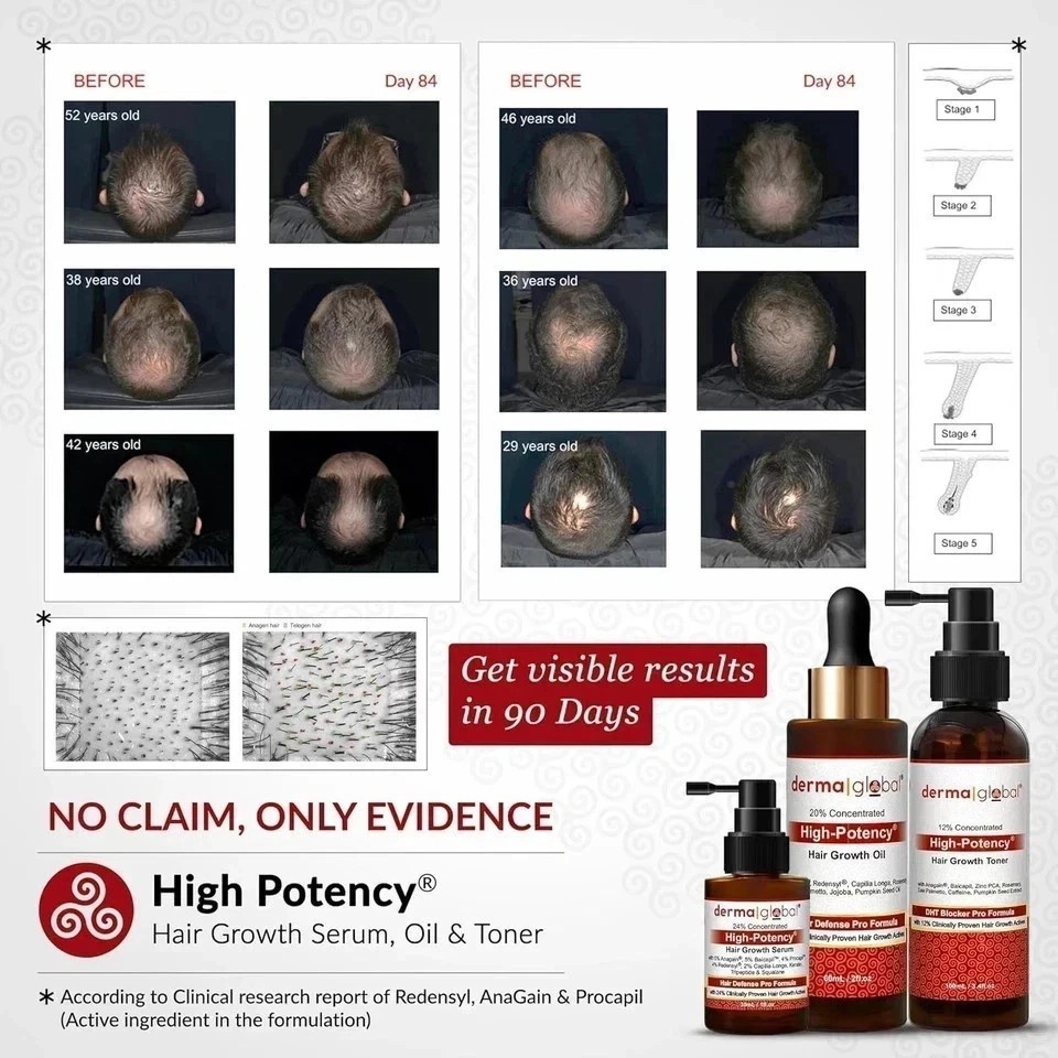 Derma Global Hair Serum – Intensive Scalp Care Formula – High Potency (One)