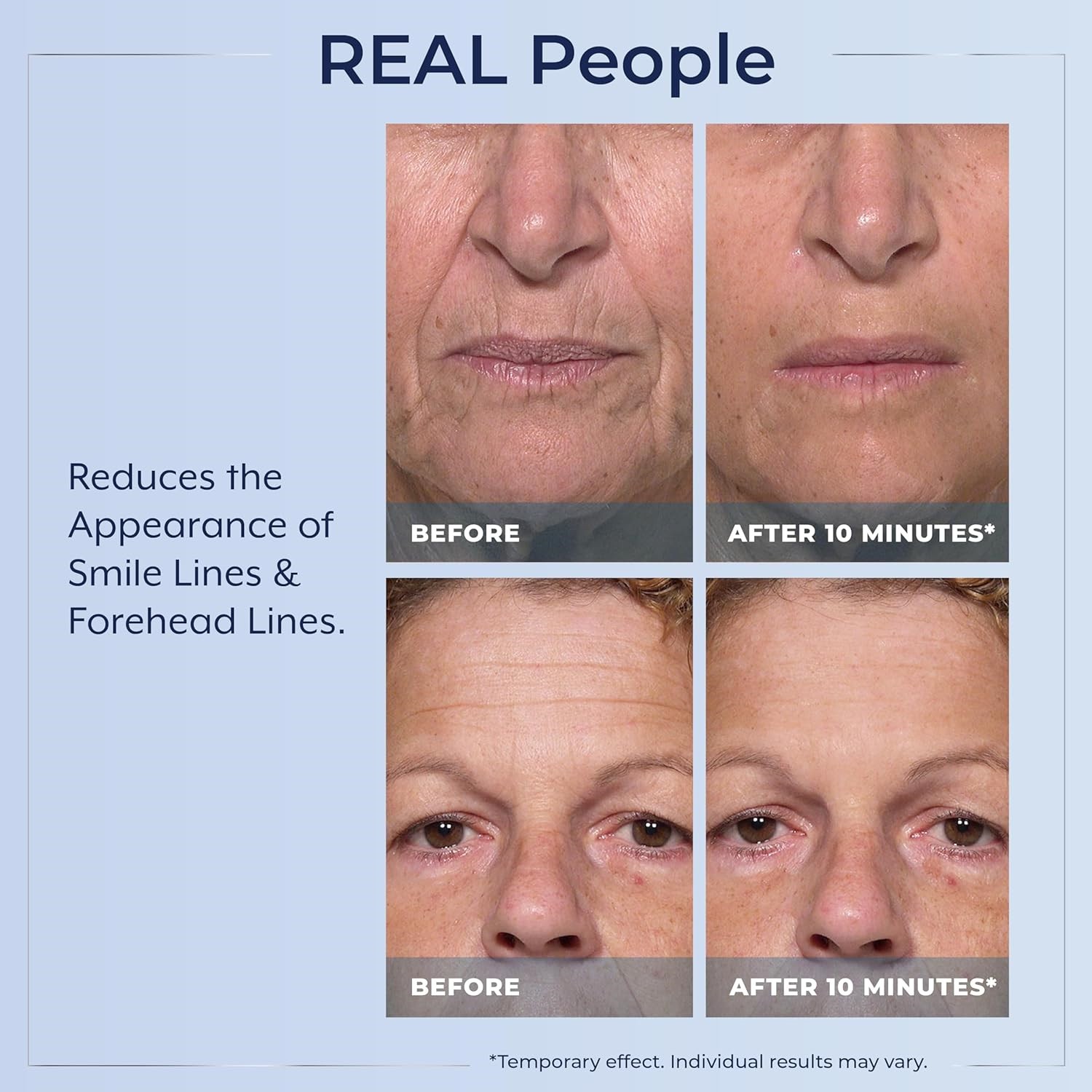 3X Plexaderm Rapid Reduction Eye Serum – Visibly Reduces Under-Eye Bags,Wrinkles