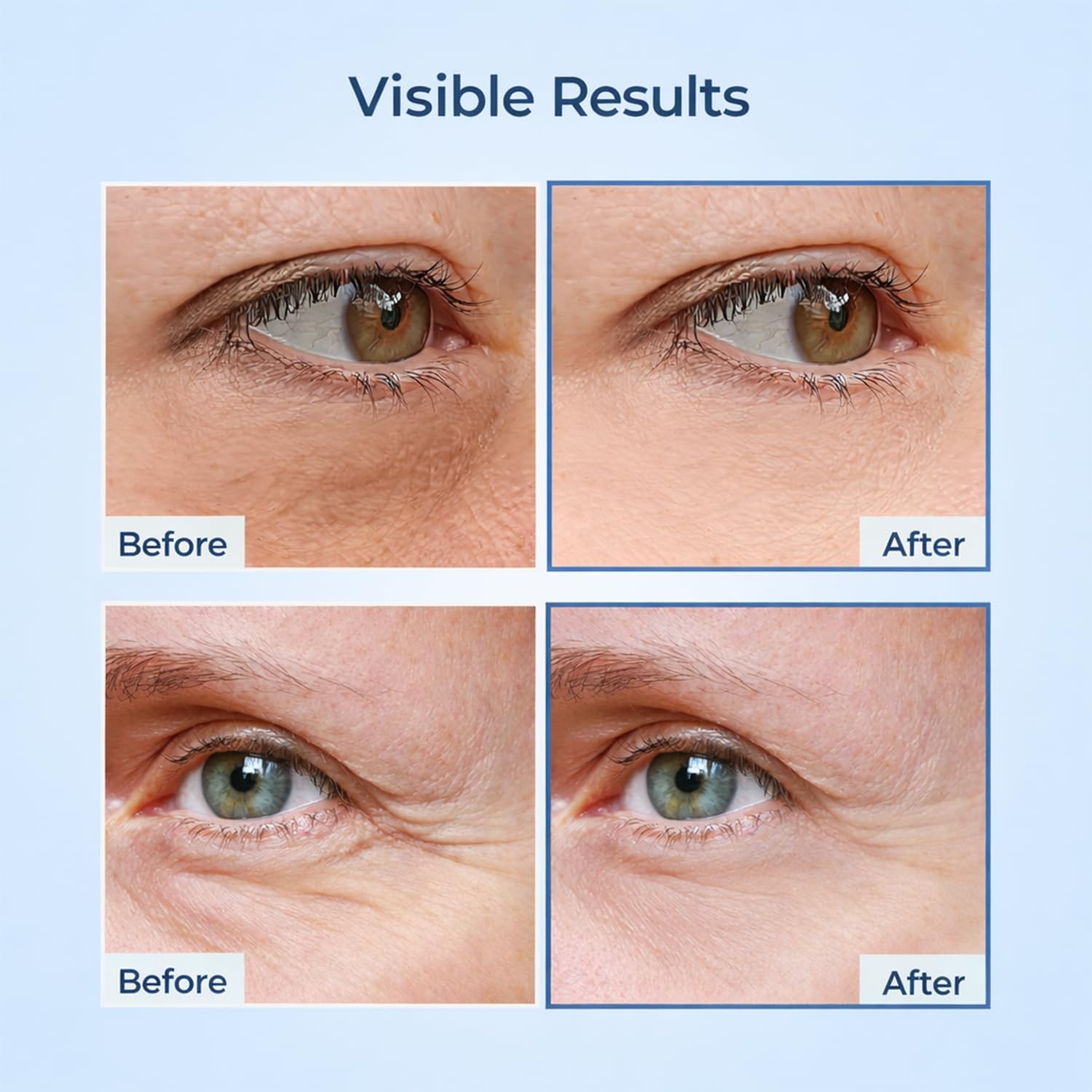 Natural Eye Serum for Firming & Dark Circle Reduction – Daily Anti-Aging Care