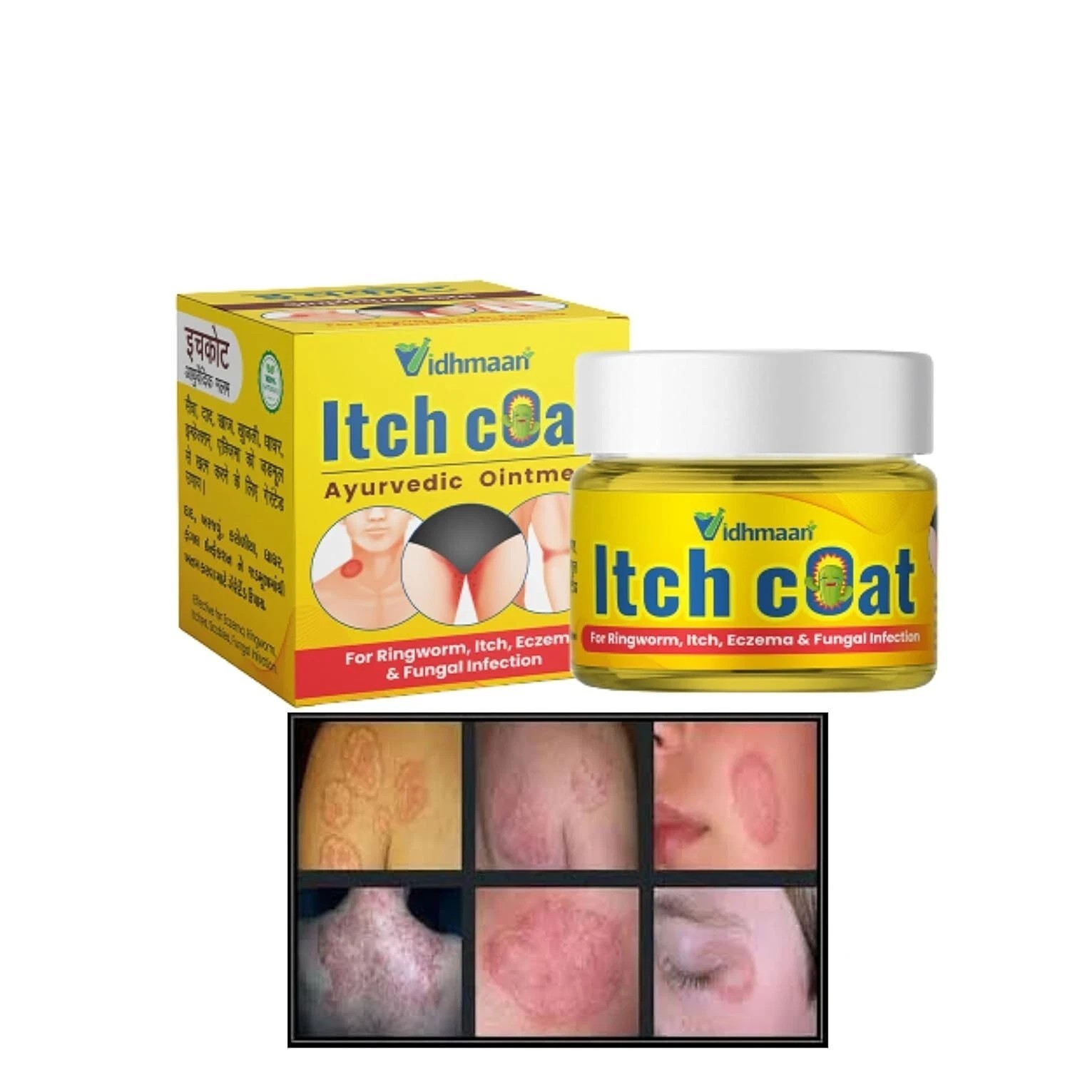 3 X Vidhmaan Ayurveda Itch Coat fungal Malam Ointment – for Ringworm, itching