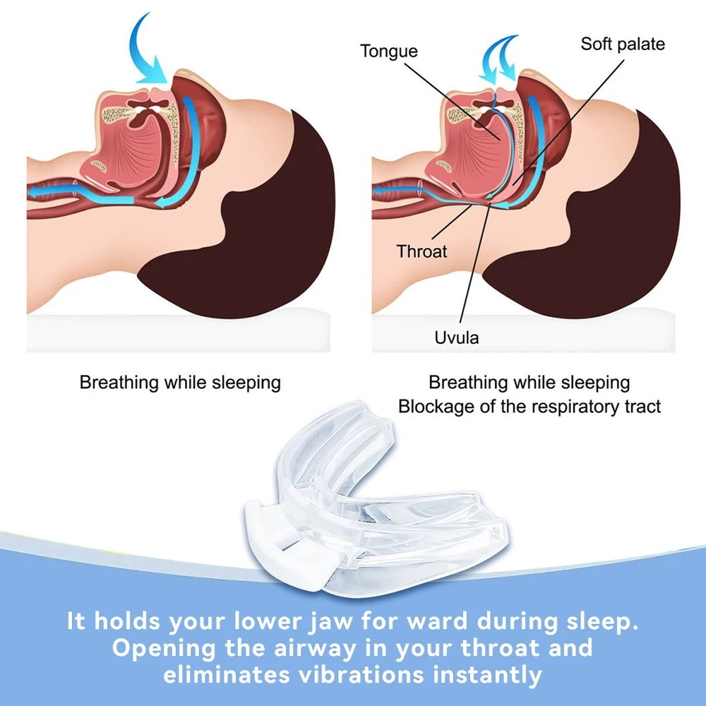 Anti Snoring Mouth Guard, Adjustable Tooth Brace, BPA Free, With Case