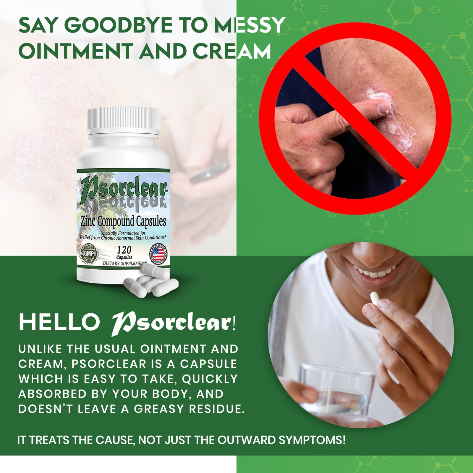 Psorclear – Proven Effective Treatment for Psoriasis & Eczema that REALLY WORKS!