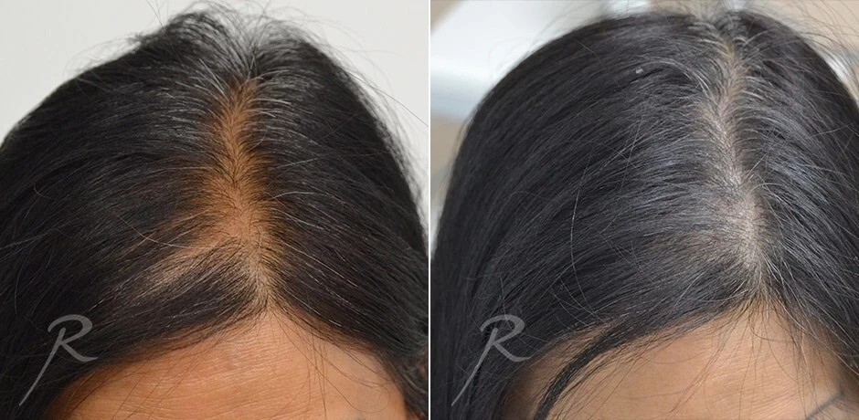 7 Days Black Seed Onion Hair Oil / Hair Fall Control & Hair Growth 100ml