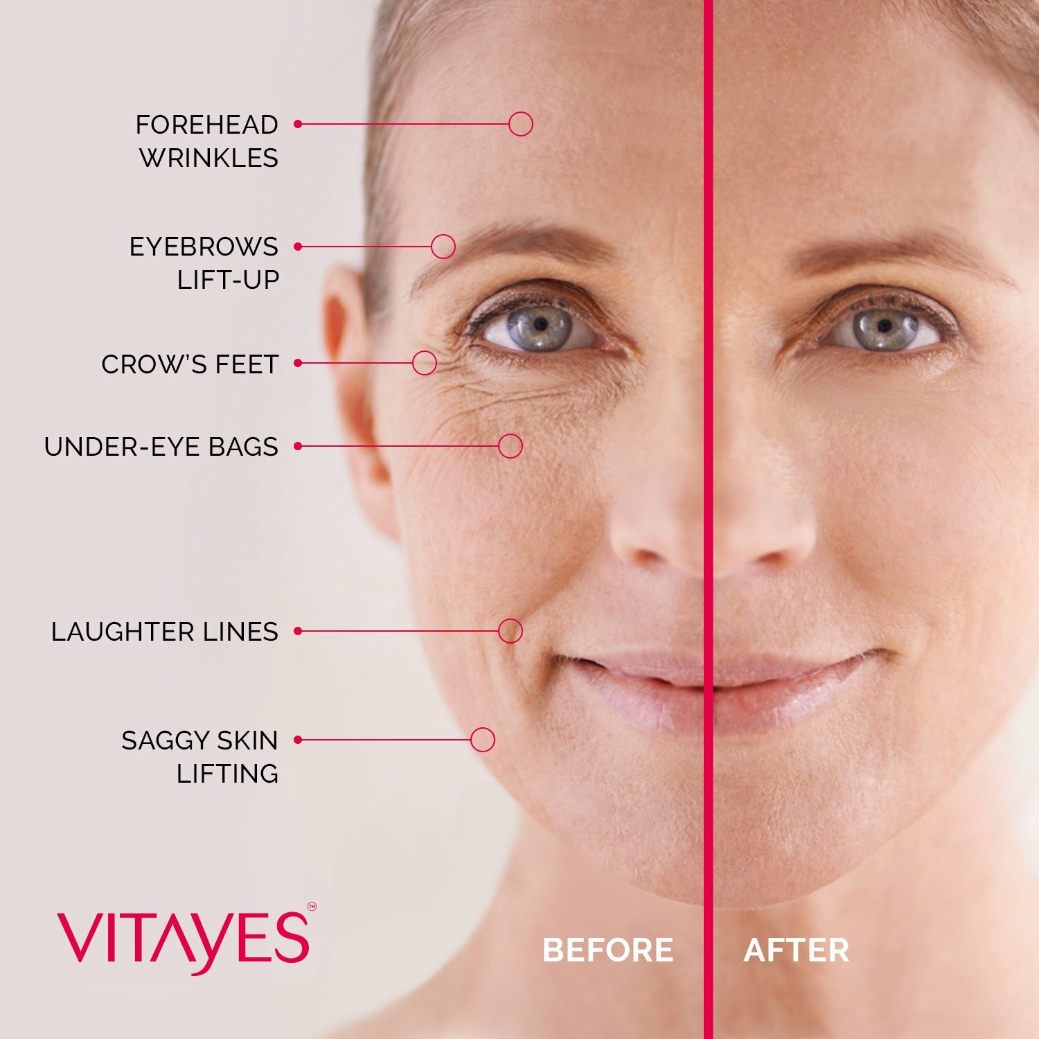 VITAYES Instant Ageback Anti-Aging Facelift Cream (15 ml Tube)