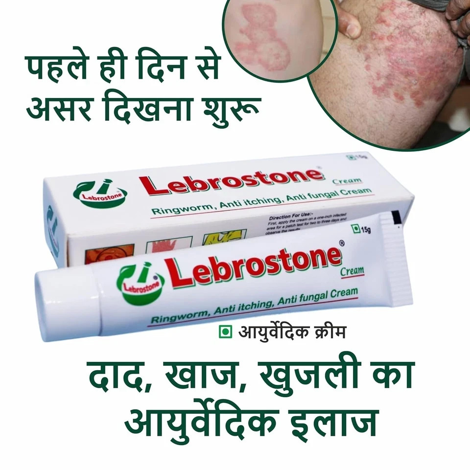 Lebrostone Cream Treatment for Ringworm Anty Itching & Anty Fungal Infections