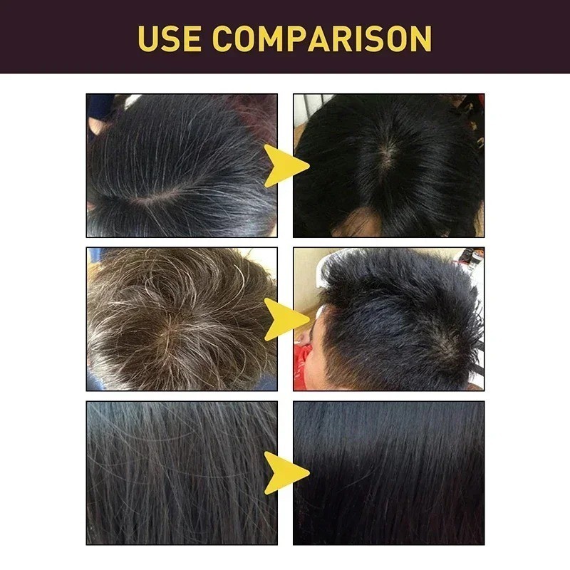 Instant Black Hair Dye Shampoo for Women & Men,3 in 1 Magic Hair Color Shampoo