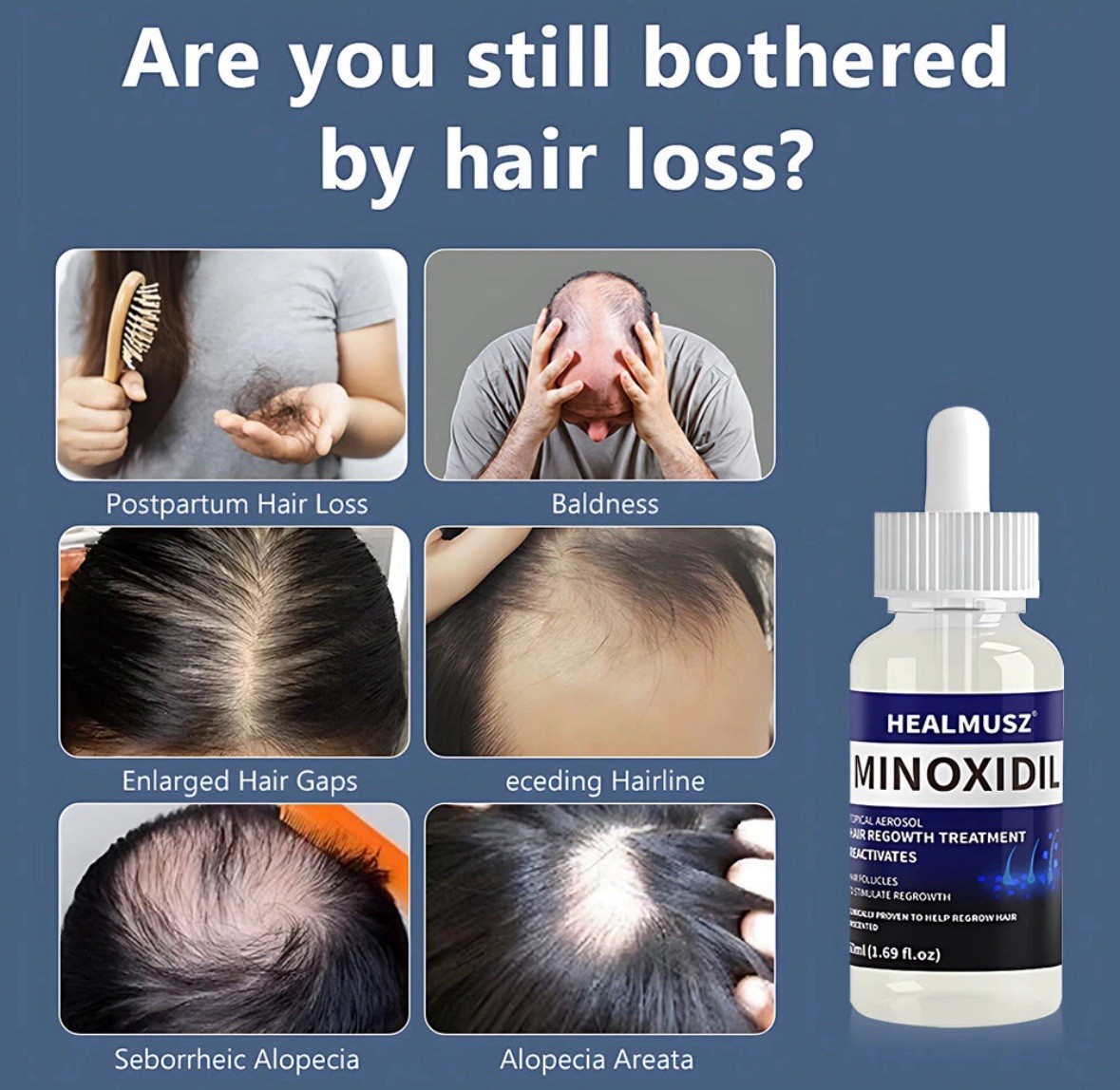 14 Pack Minoxidil 5% Extra Strength Men Hair Regrowth Treatment 14 Month Supply