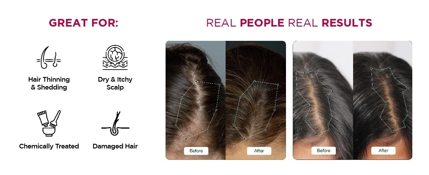 Rosemary Redensyl Hair Growth Serum & Anti Greying Booster Concentrate 30ml