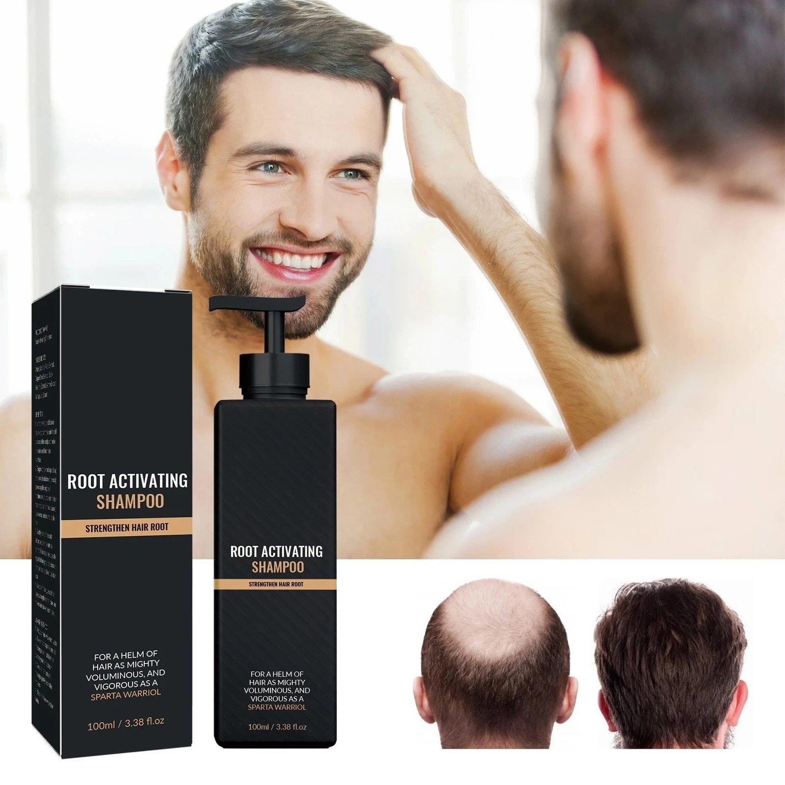 Root Activator Shampoo SPARTAN Hair Loss Shampoo Root Activator ( 100ml )