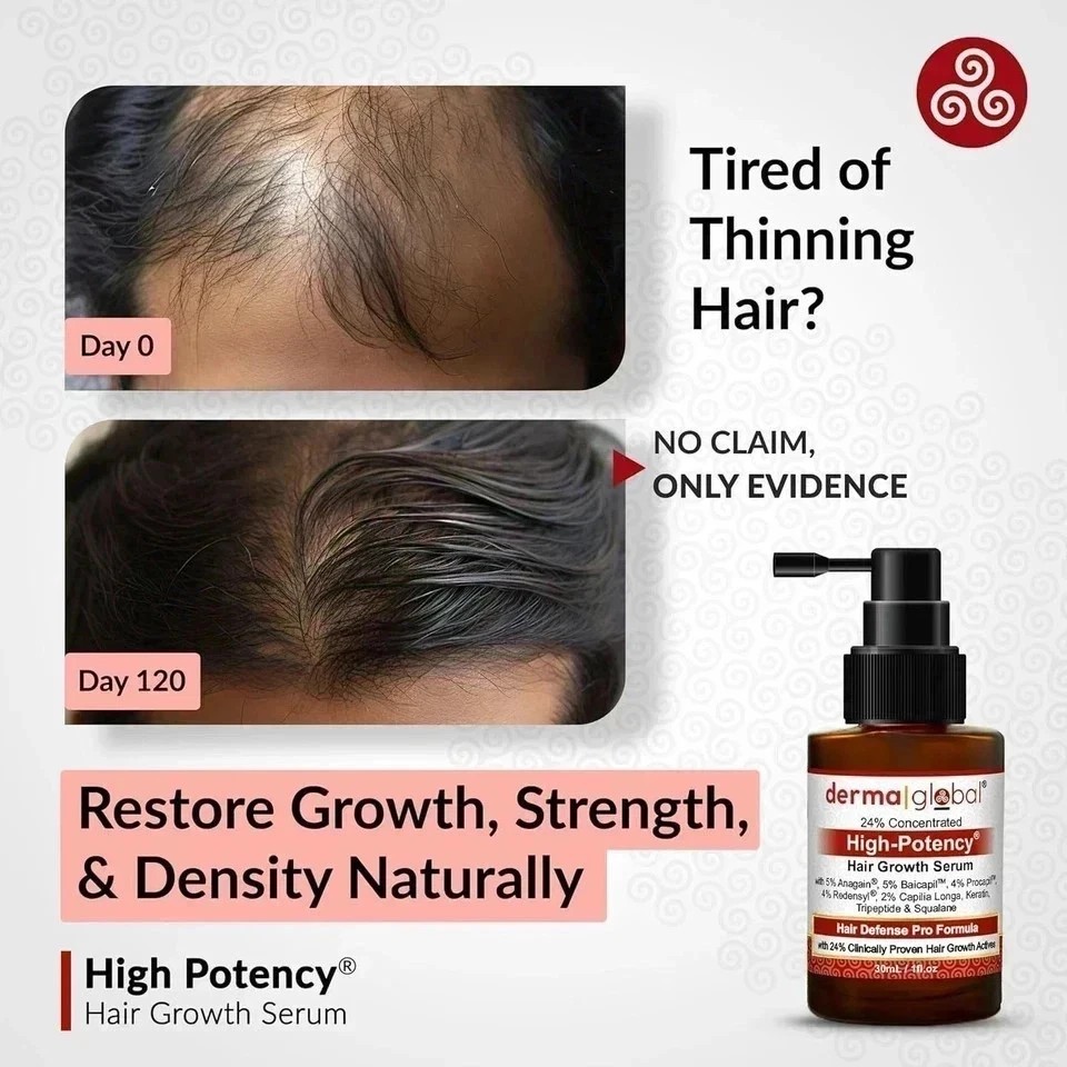 Derma Global Hair Serum – Intensive Scalp Care Formula – High Potency (One)