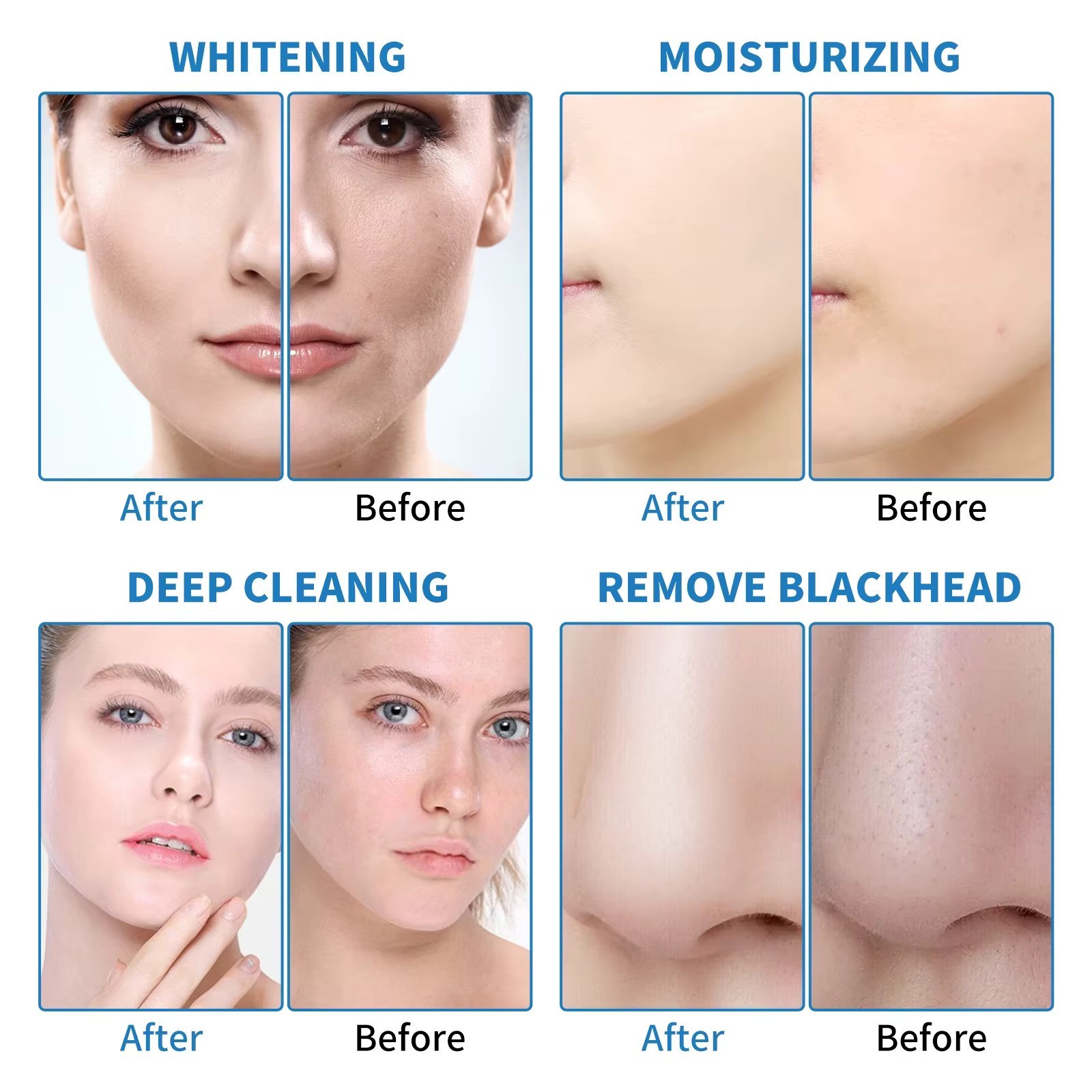 14in1 Hydra Spa Facial Beauty Machine Hydro Dermabrasion Face Skin Cleaning Face