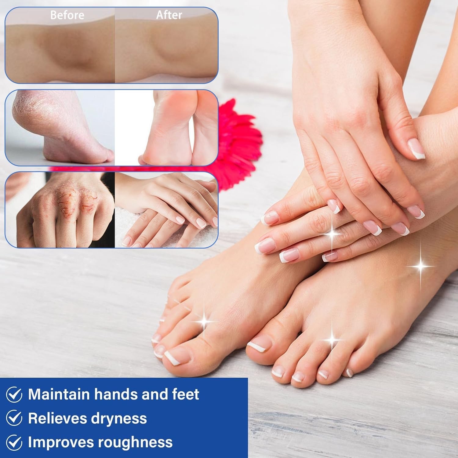 Luxury Urea Cream 60% with 2% Salicylic Acid for Deep Hydration & Softening