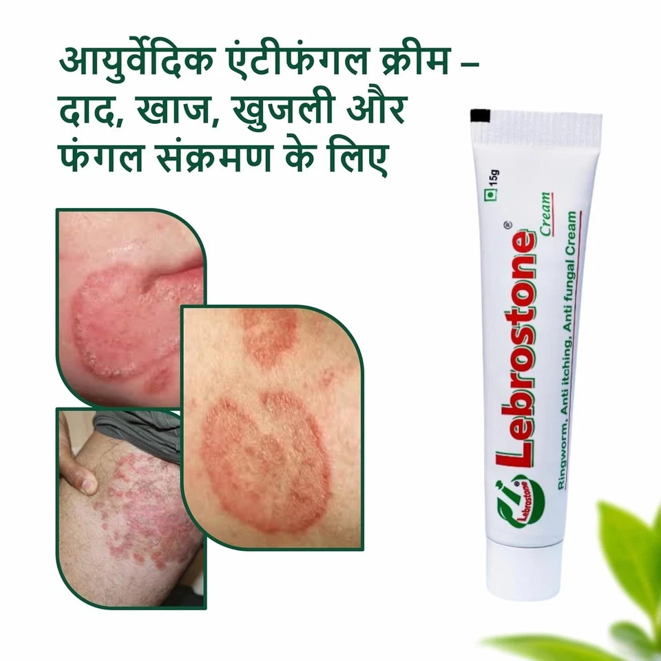 Lebrostone Cream Treatment for Ringworm Anty Itching & Anty Fungal Infections