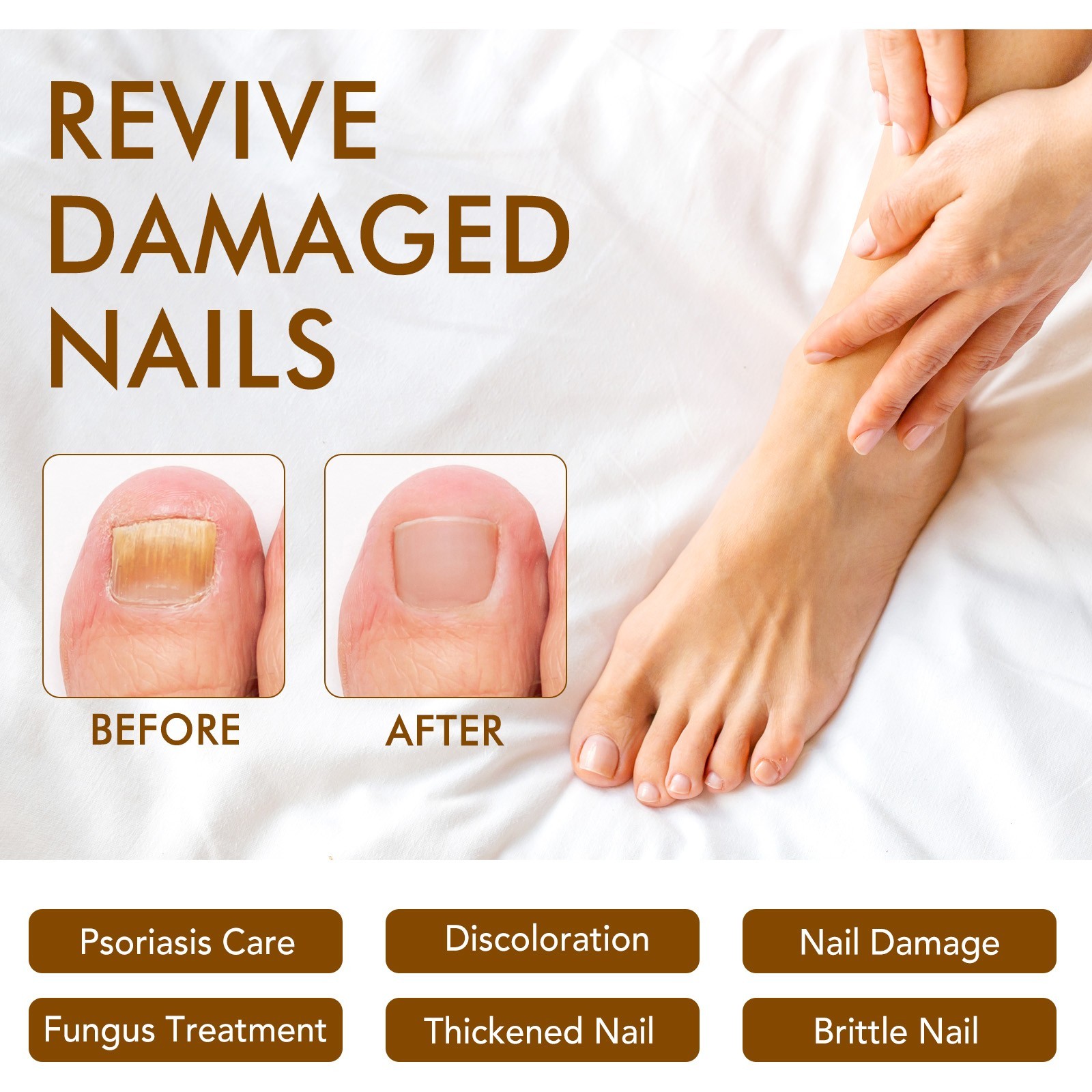 7 Days Nail Fungus Treatment – Extra Strength Repair for Nails & Cuticles 60ML
