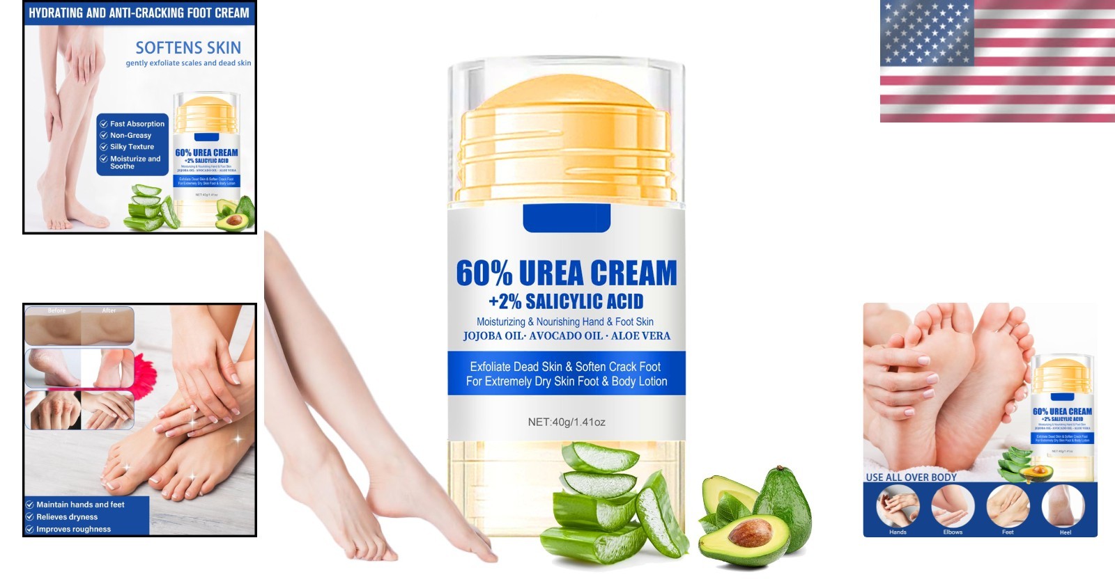 Luxury Urea Cream 60% with 2% Salicylic Acid for Deep Hydration & Softening