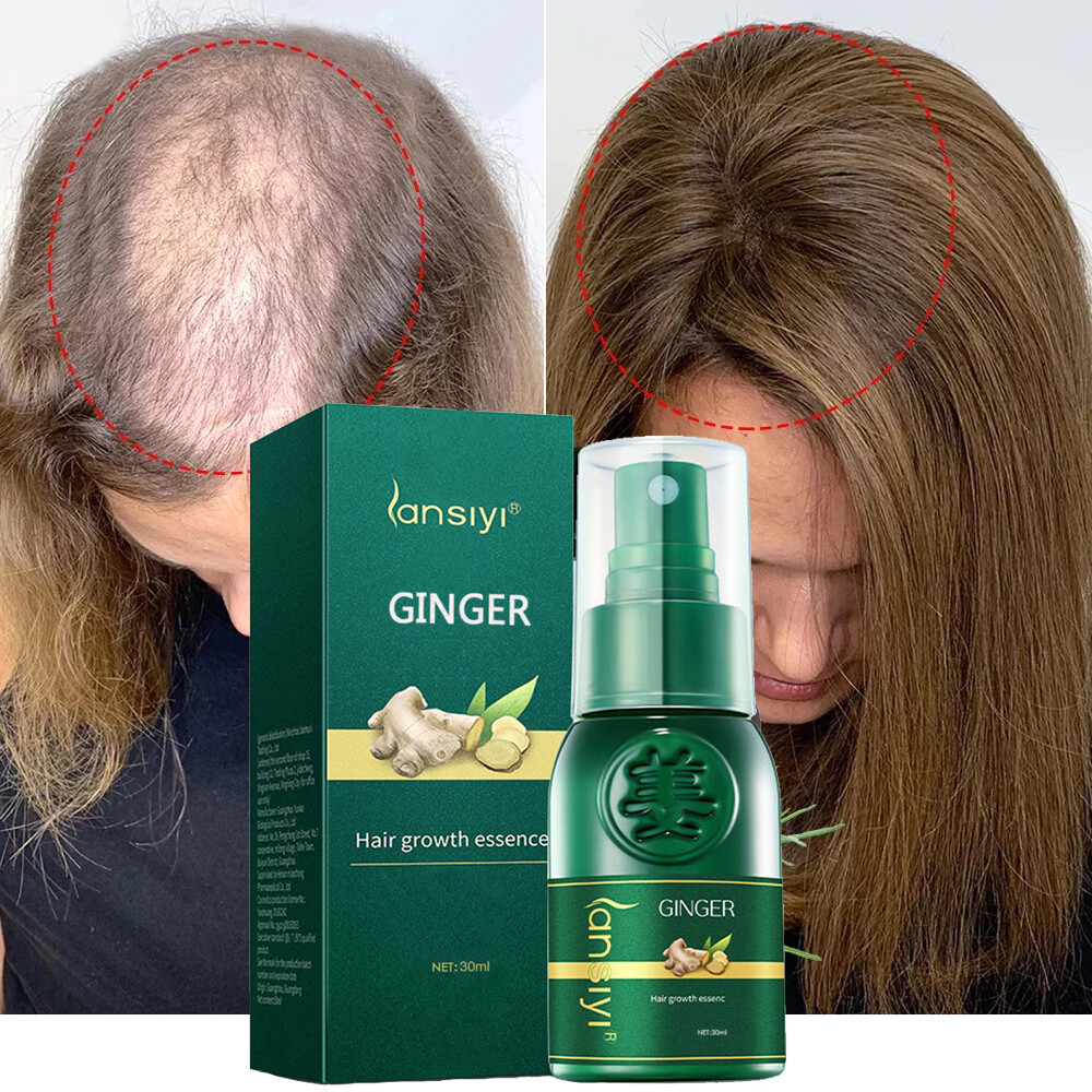 Herbal Ginger Hair Growth Spray Anti Hair Loss Treatment Dense Regrowth Essence.