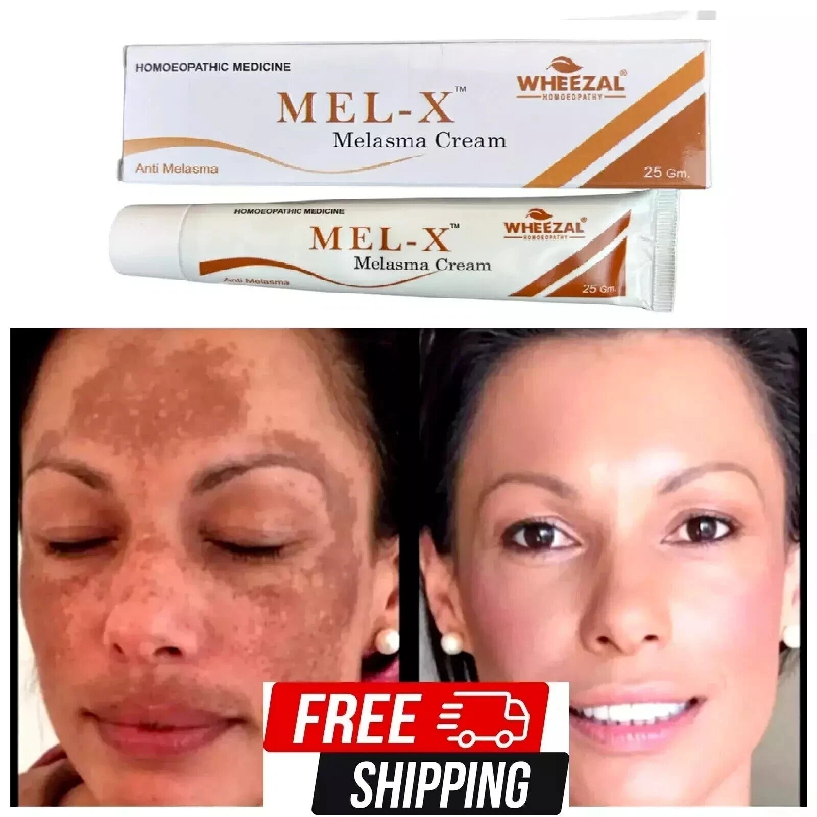 Wheezal Mel X Melasma Cream 25gm free shipping
