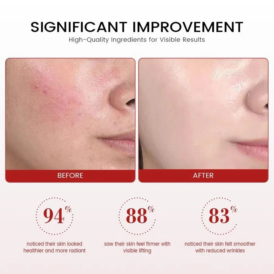 Koriderm Time Reverse Cream, Koriderm Cream for Face for All Skin Types-50ml