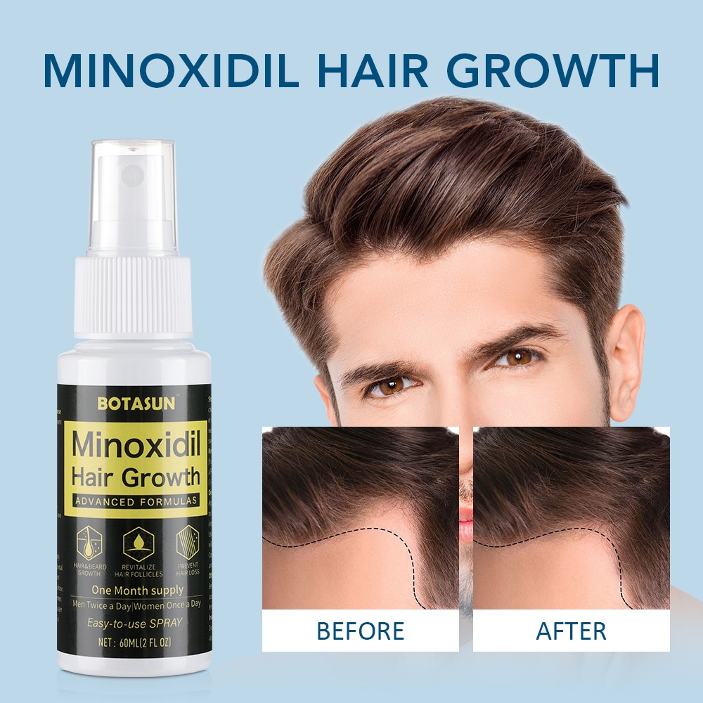 Minoxidil 5% Hair Regrowth Treatment Topical Solution for Men 2-10 Month Supply