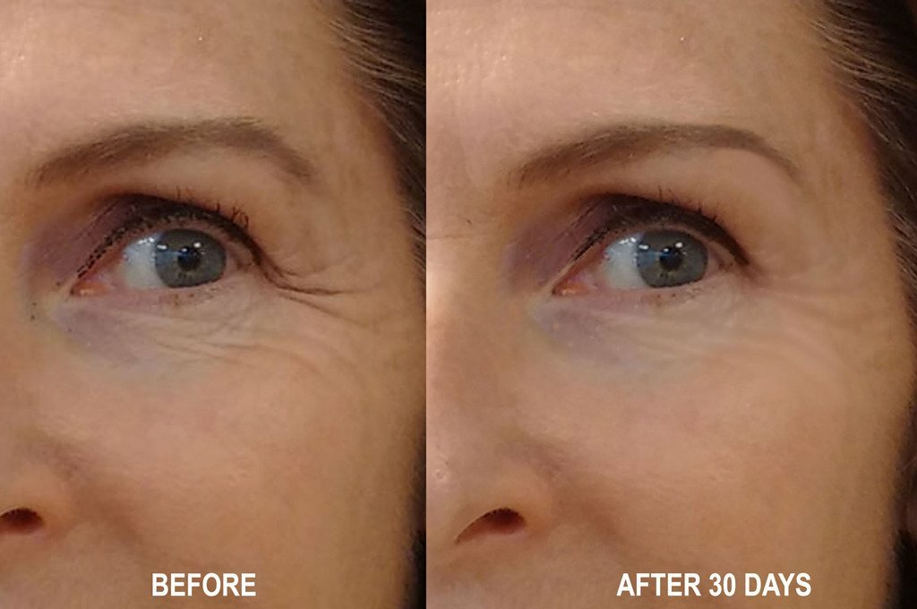 Argireline Matrixyl 3000 Hyaluronic Acid Peptide Serum Wrinkle Collagen Cream
