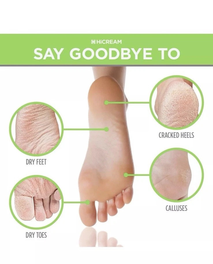 Foot Peel Mask For Baby Soft Feet: Lot Of 2 Boxes (2 Pack Per Box Exp. 01/2025)