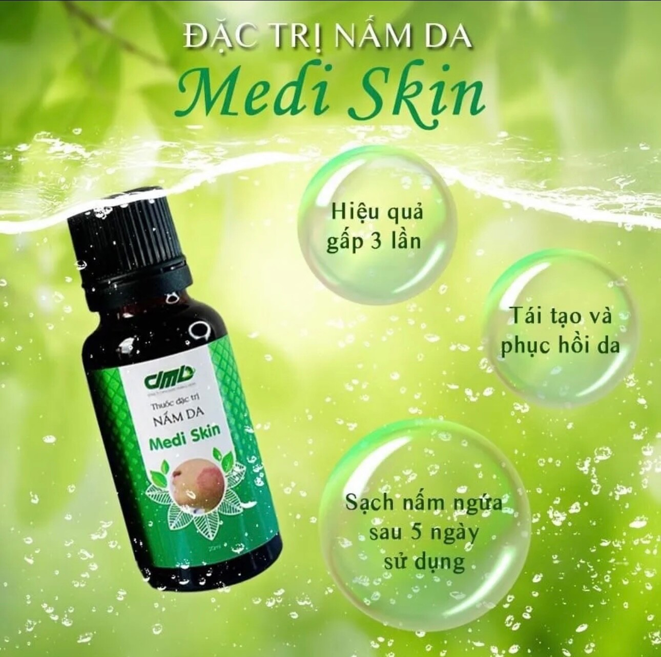 DMD- COMBO OF MEDI SKIN TREATMENT FOR PSORIASIS,ECZEMA.