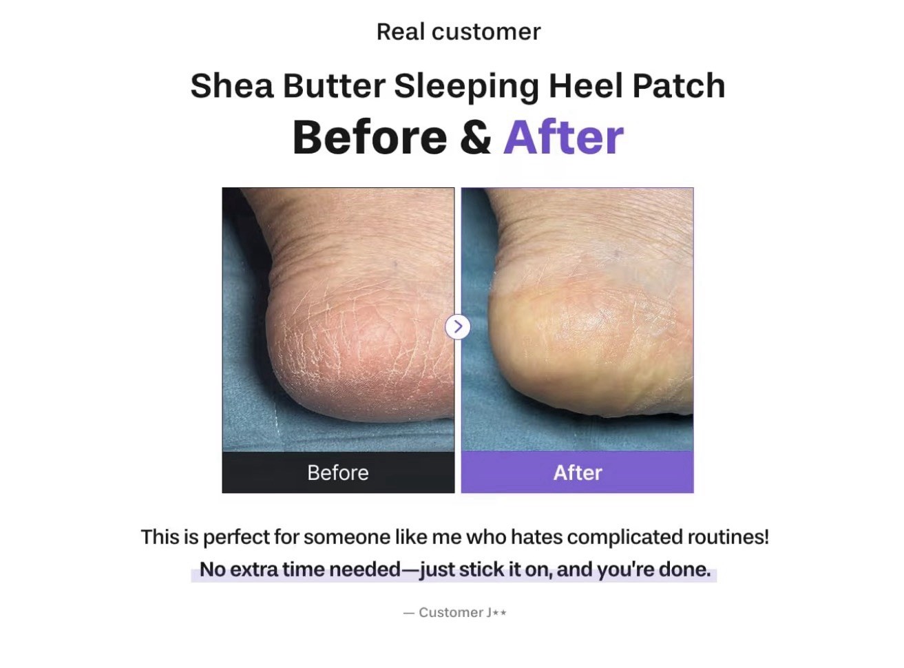 baren Shea Butter Sleeping Heel Patch for Cracked Heels 10 Patches 0.5g