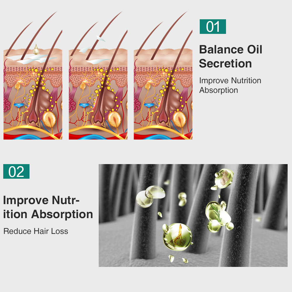 Herbal Ginger Hair Growth Spray Anti Hair Loss Treatment Dense Regrowth Essence.