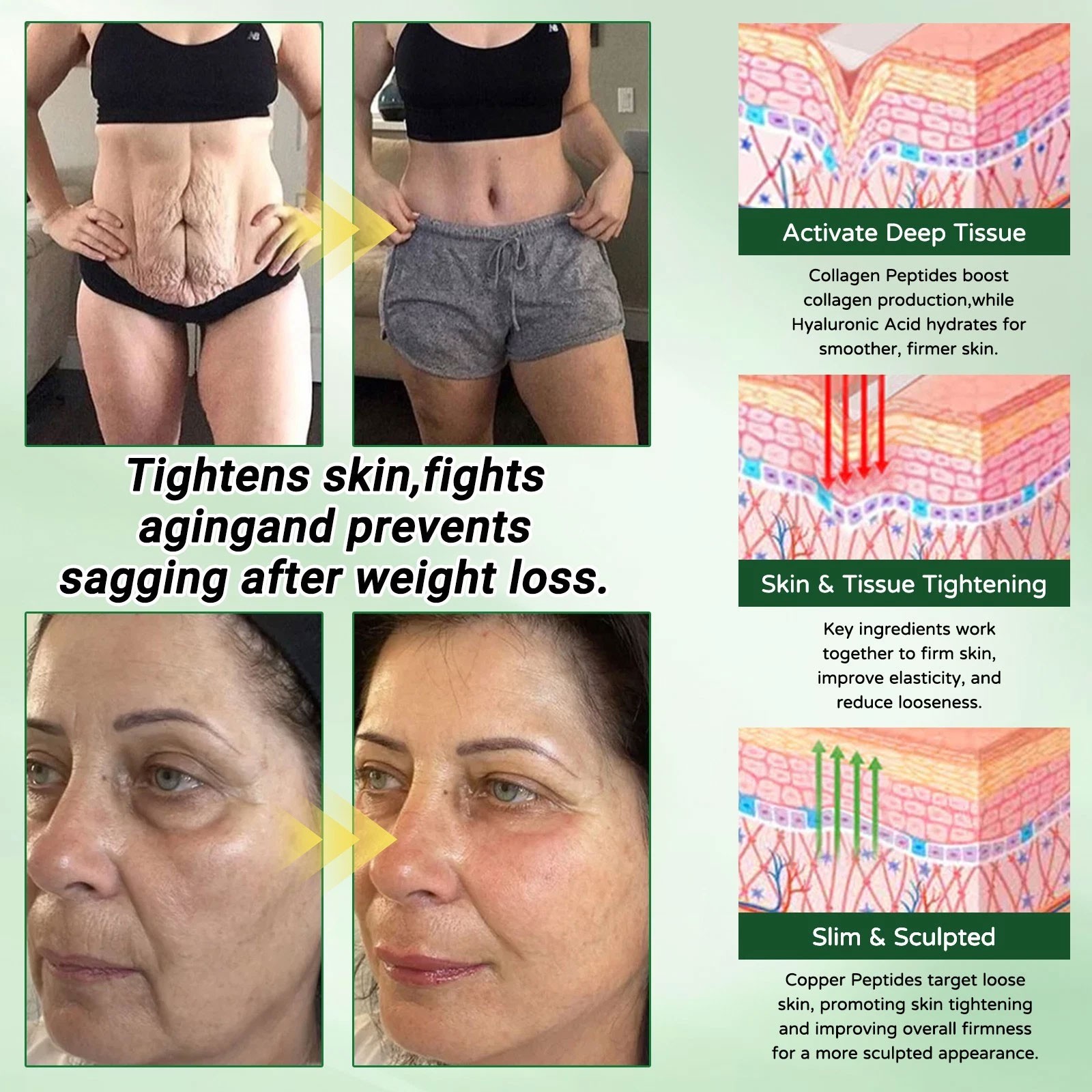 InsLemon Moringa Berberine AMPK 10-in-1 Metabolic Support Nano Microneedle Pat1x