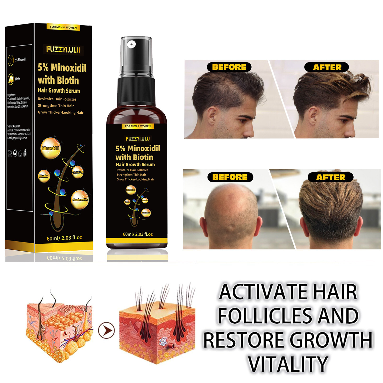 5% Minoxidil Biotin Hair Growth Serum, For Thicker Fuller Healthier Hair 60ml