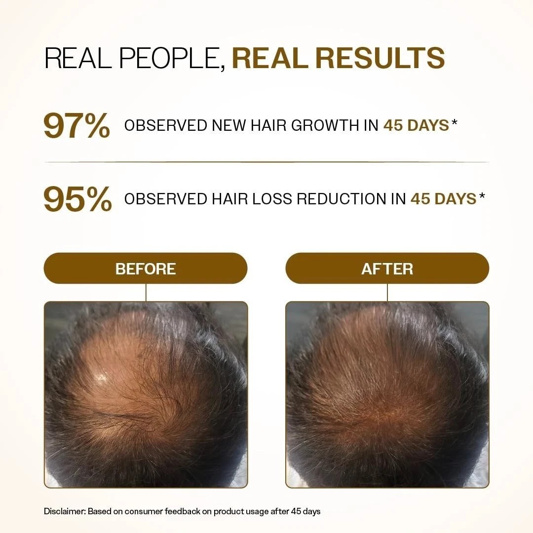 Bare anatomy Advance hair Growth serum roll on