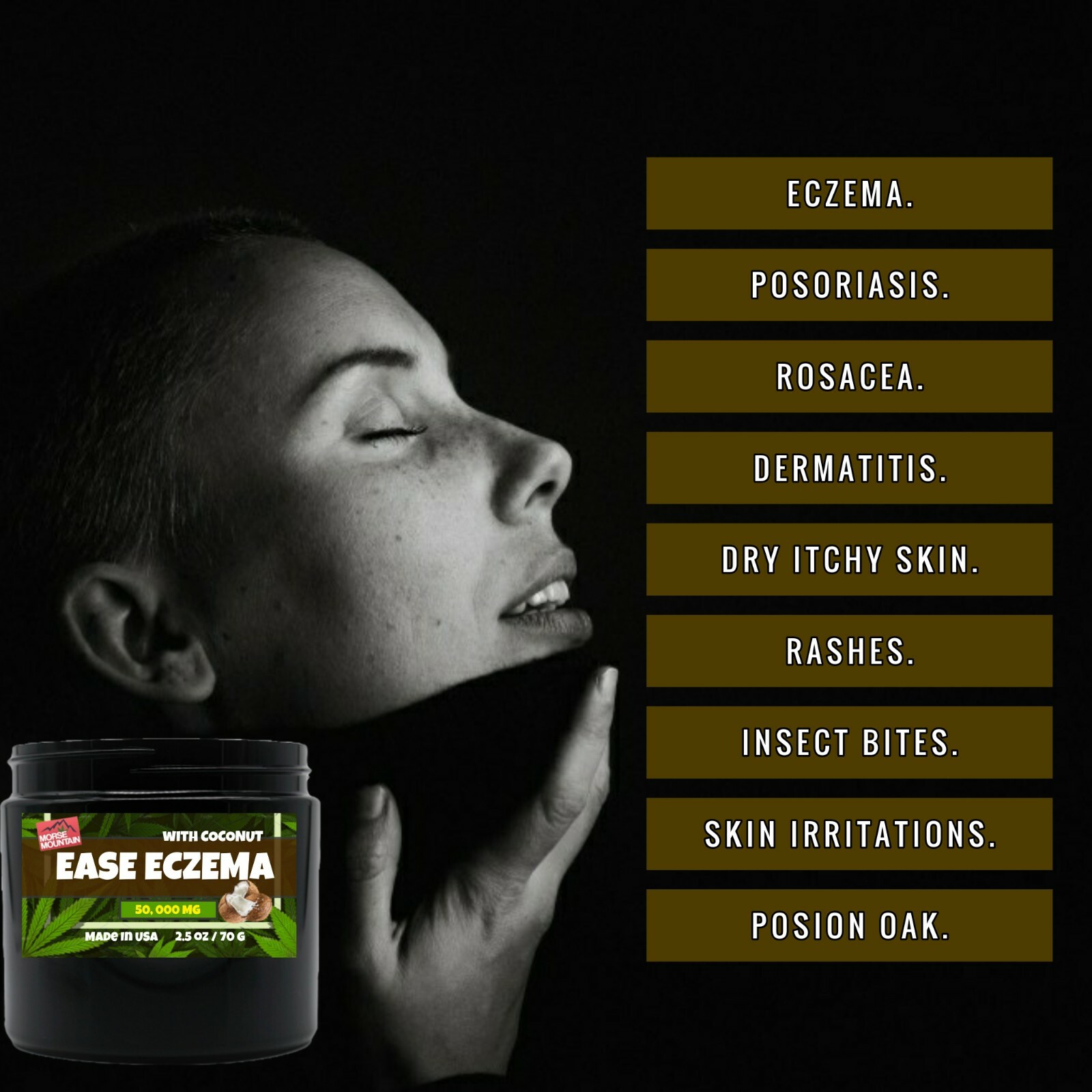 Hempseed Psoriasis Eczema cream, Dermatitis, Dry Skin Care flareups Anti Itch 