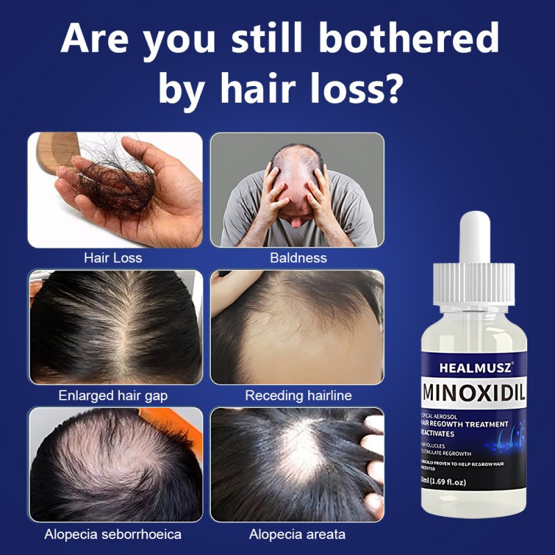 Minoxidil 5% Hair Regrowth Solution Extra Strength Men Women 2-10 Months Supply