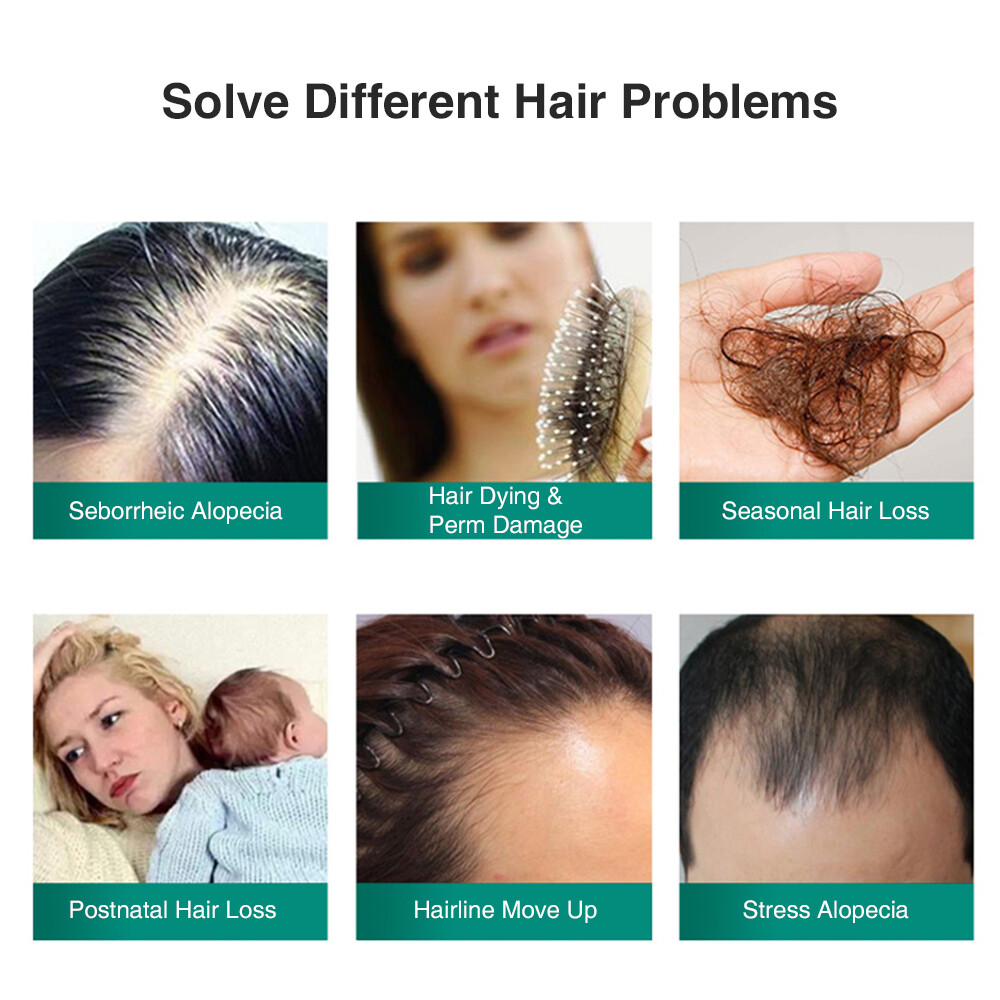 Herbal Ginger Hair Growth Spray Anti Hair Loss Treatment Dense Regrowth Essence.
