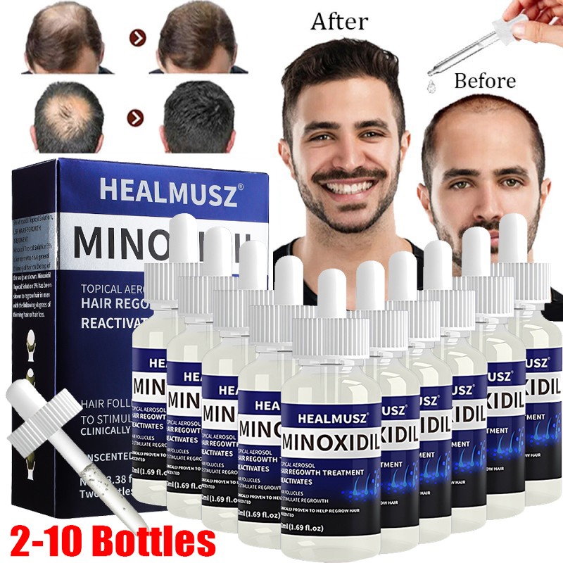 Minoxidil 5% Hair Regrowth Solution Extra Strength Men Women 2-10 Months Supply