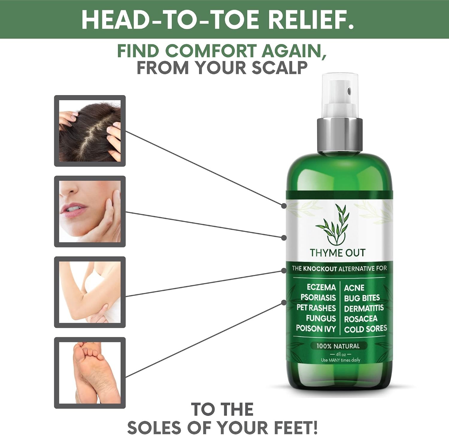 Thyme Out All Natural Eczema Treatment- Psoriasis Treatment – an All-in-One