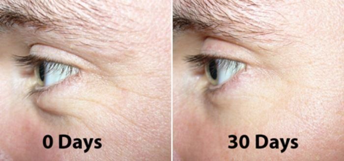 Argireline Matrixyl 3000 Hyaluronic Acid Peptide Serum Wrinkle Collagen Cream