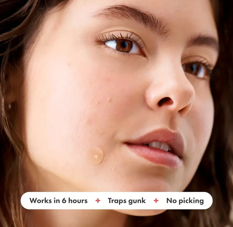 36 Pimple Patches Dots Hydrocolloid Acne Spot Stickers Cystic Acne Patch Heal