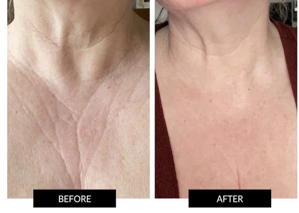 CurrentBody Skin LED Neck & Décolletage Fully Wearable Anti-Aging Mask New Open