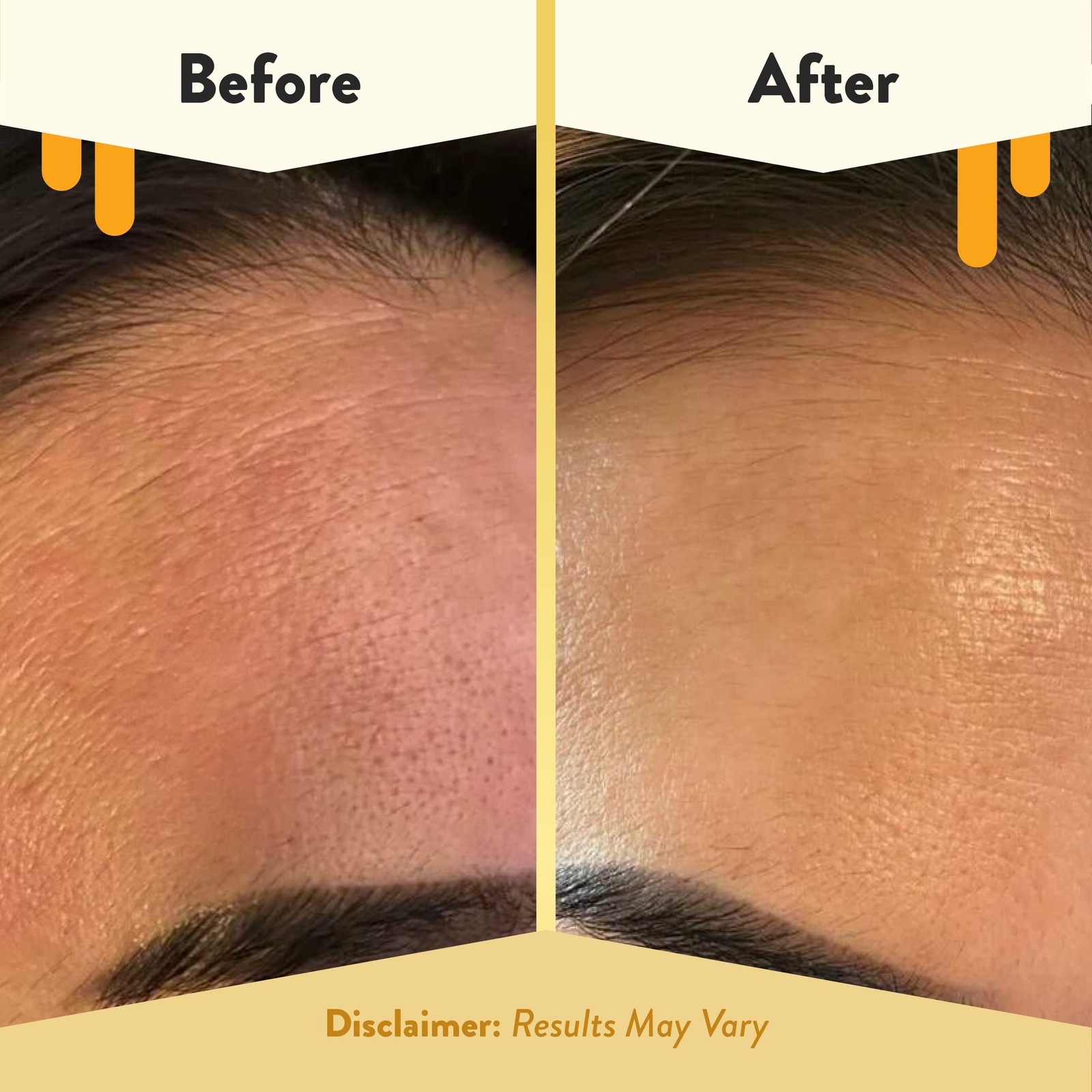 Eczema Honey Oatmeal Facial Cleanser – Natural Eczema Face Wash Prevents