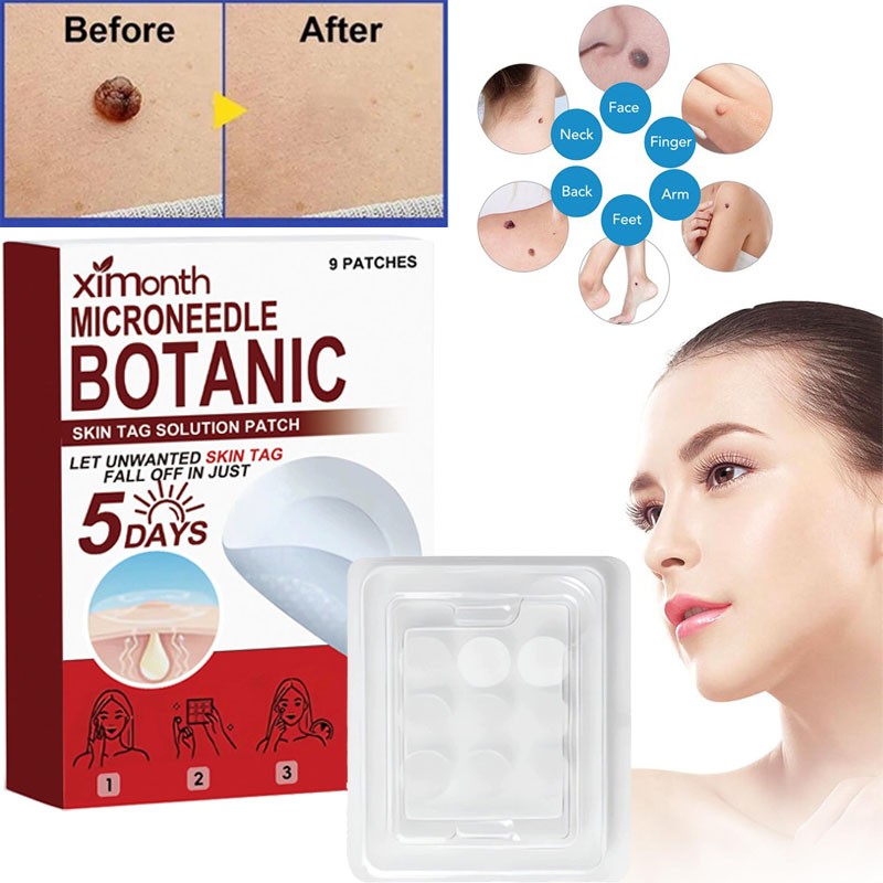 1-5 *Box MICRONEEDLE BOTANIC Skin Tag & Acne Patch Skin Tag Remover Patches