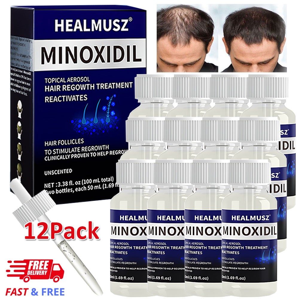 6Pack Minoxidil 5% Extra Strength Hair Regrowth Treatment for Men 6 Month Supply