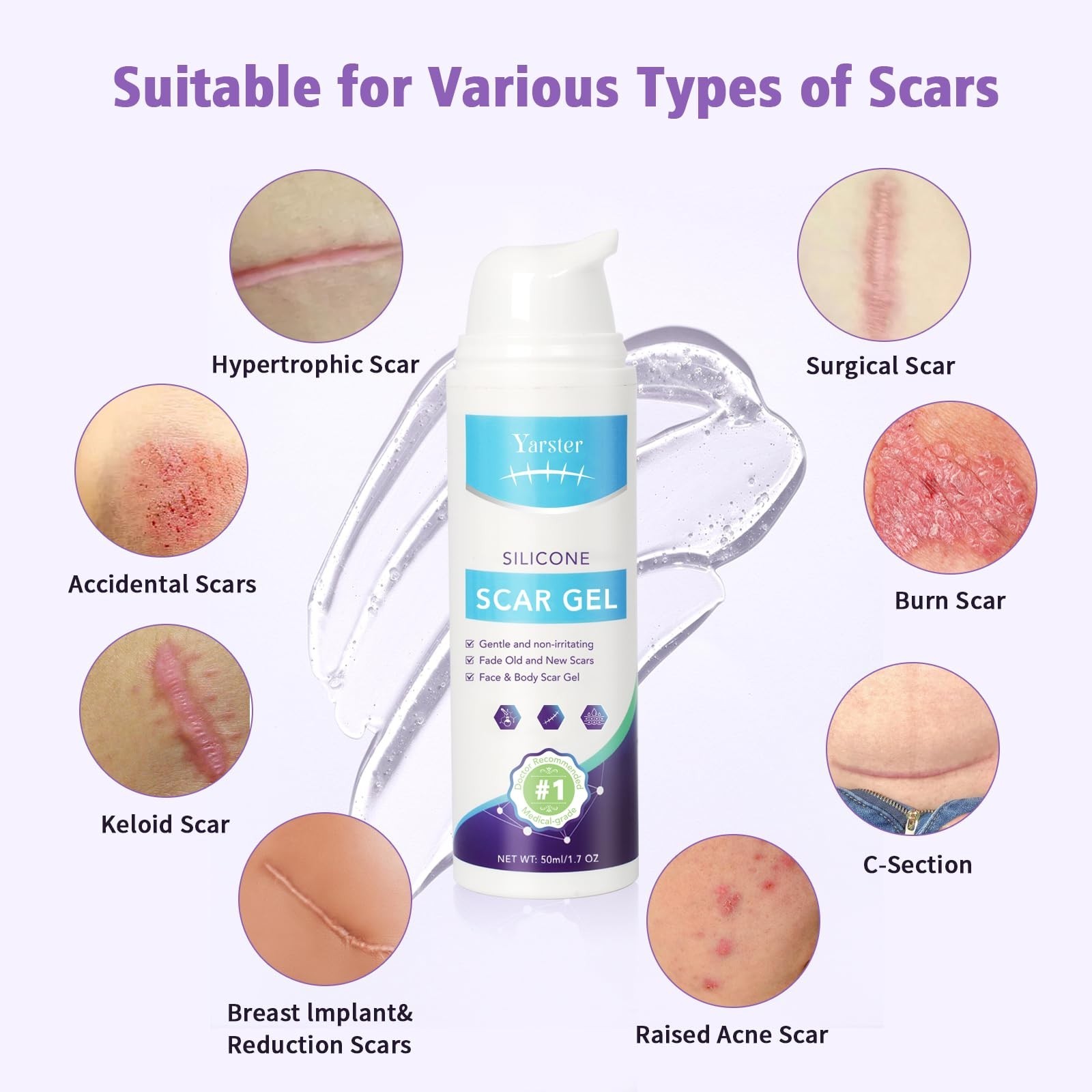 Medical Grade Silicone Scar Gel for Surgical & Acne Scars, 1.7oz – Fast Healing