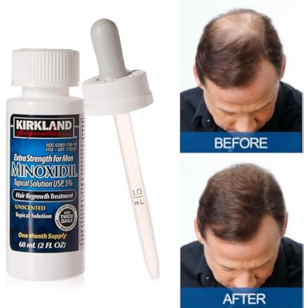 Kirkland Minoxidil 5% Extra Strength Men 6 Month Supply Hair Regrowth