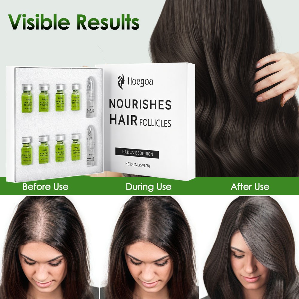 Hair Regrowth System,Advanced Hair Growth Treatment for Men & Women
